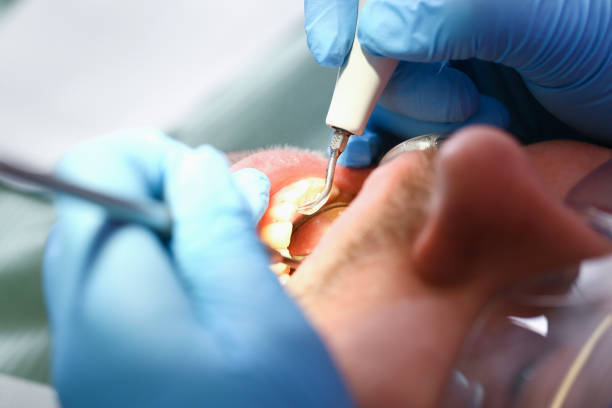 Best Chipped Tooth Repair Near Me  in Laughlin, NV