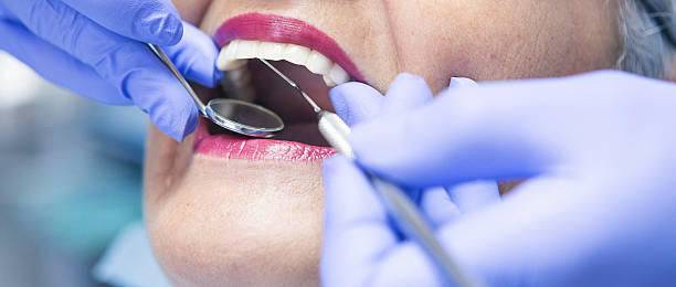 Best Chipped Tooth Repair Near Me  in Laughlin, NV